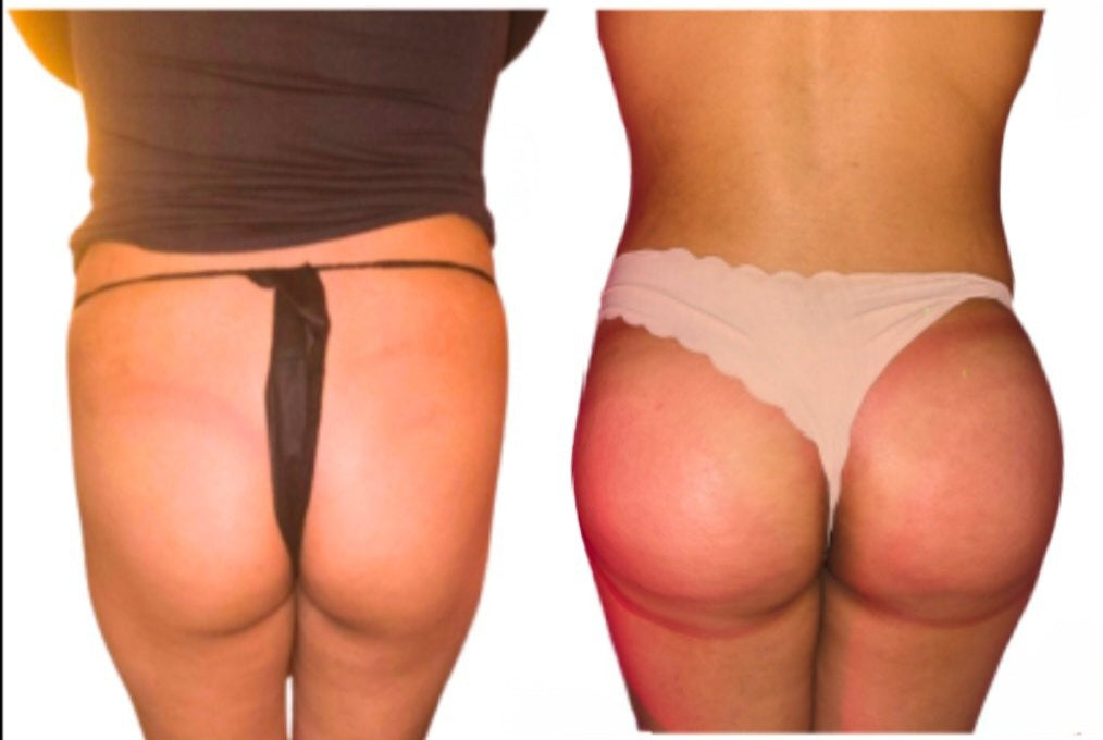 Natural Butt Enhancement Oils, body care plumping serum. BBL Brazilian Butt Lift Non Invasive Non Surgical in Sacramento area.