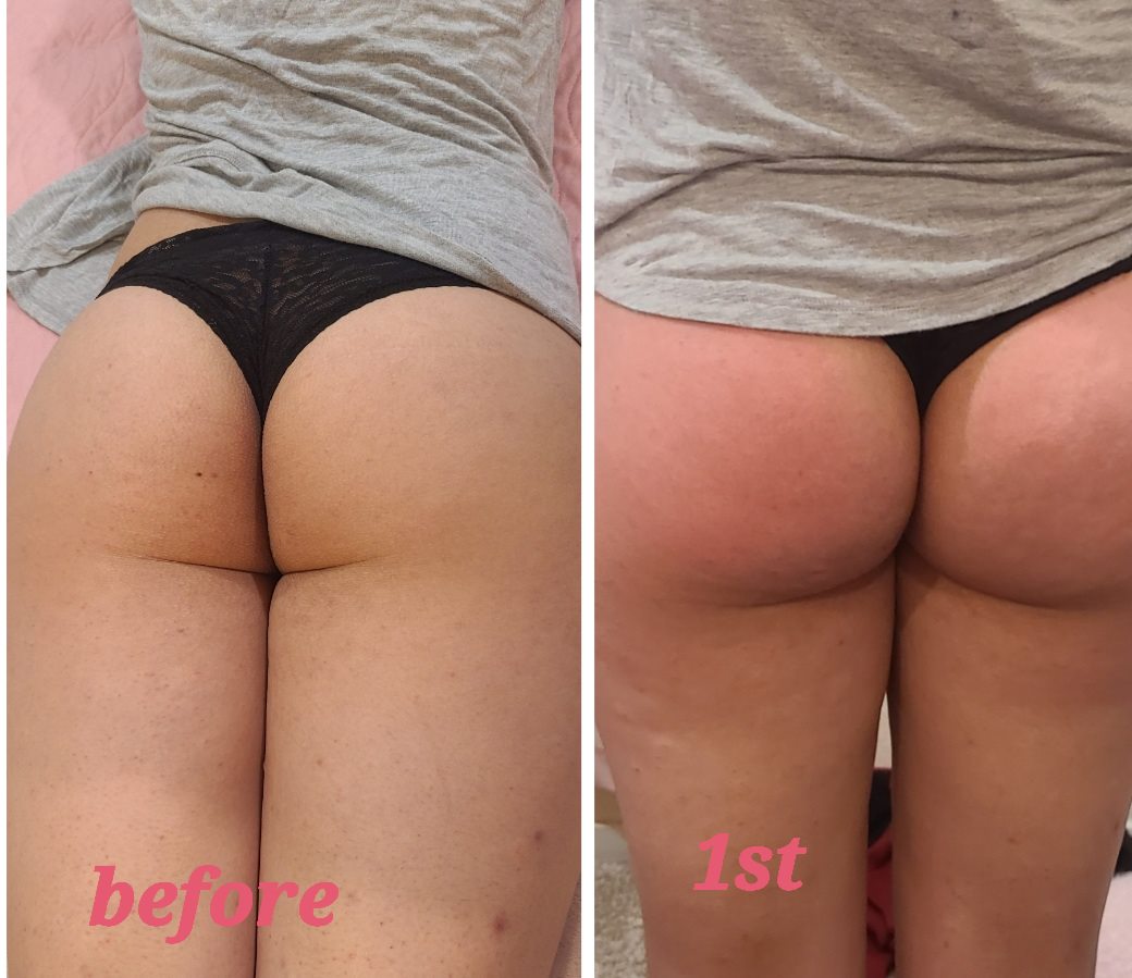 Bigger Booty Pink Serum | Natural Body Oil Plumping Serum. Natural Butt Enhancement Oils, body care plumping serum. BBL Brazilian Butt Lift Non Invasive Non Surgical in Sacramento area.