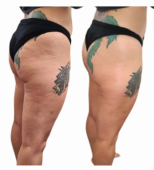 Cellulite & Fat Reducing Oil | Stretch Mark Oil Essential Oils. Cellulite & Lipo Fat Melting Cream, helps burn fat and skin tightening, along with lymphatic drainage.