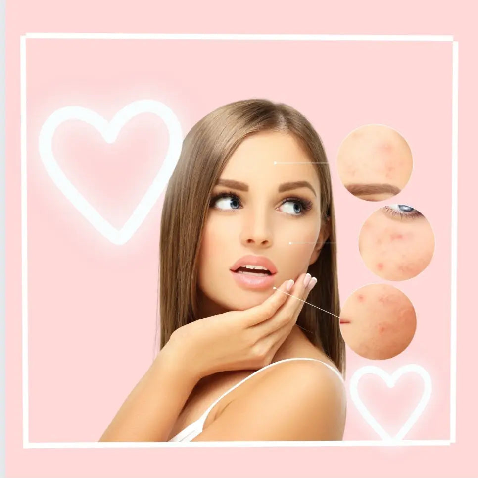 Hyperpigmentation Facial Treatment | Even Skin Tone Facial