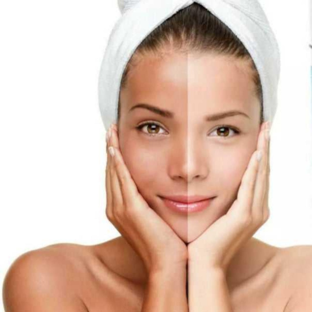 Skin Brightening Lotion Kojic Acid Body Lightening Cream