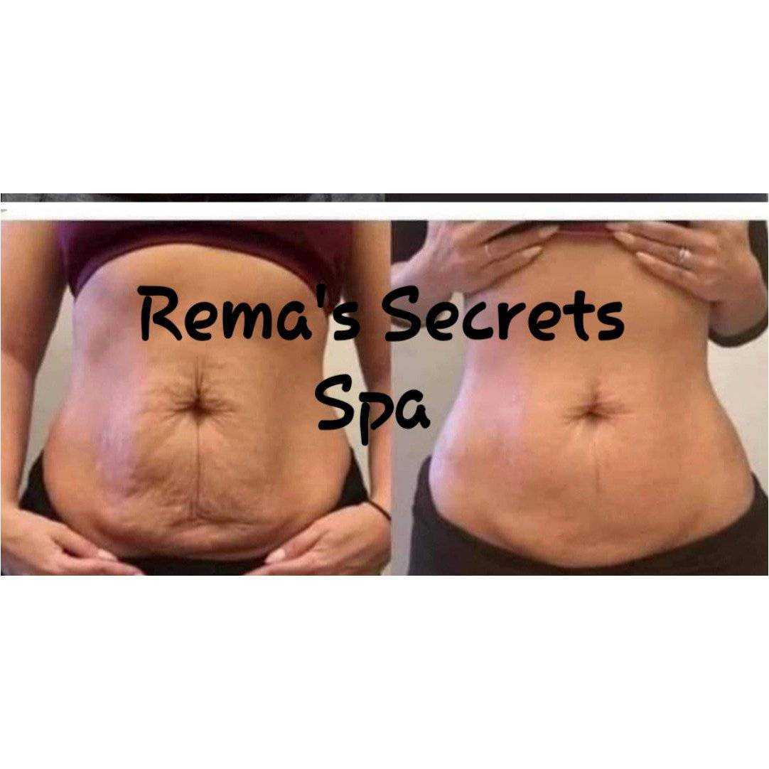 Body Sculpting Sacramento Non-Surgical Contouring Massage Spa