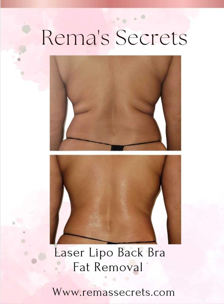 Body Sculpting Sacramento Non-Surgical Contouring Massage Spa