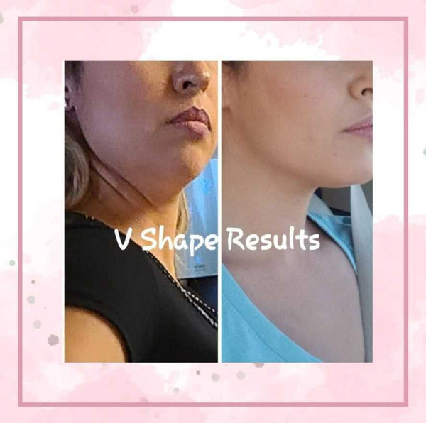 V Shape Face Moisturizer V Shape Face Moisturizer neck firming tightening cream 18 Anti Aging Skin Care