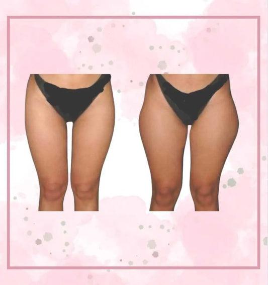 Wider Hips Oil Hour Glass Hip Oil Natural Hip Enlargement