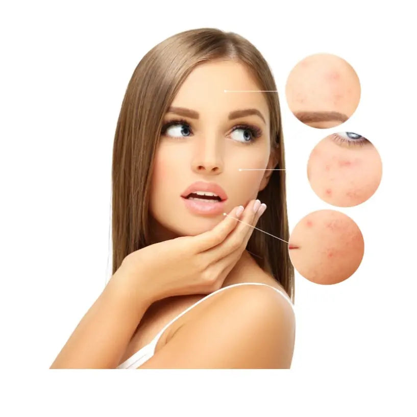 Natural acne products facial treatments unclog pores clear skin