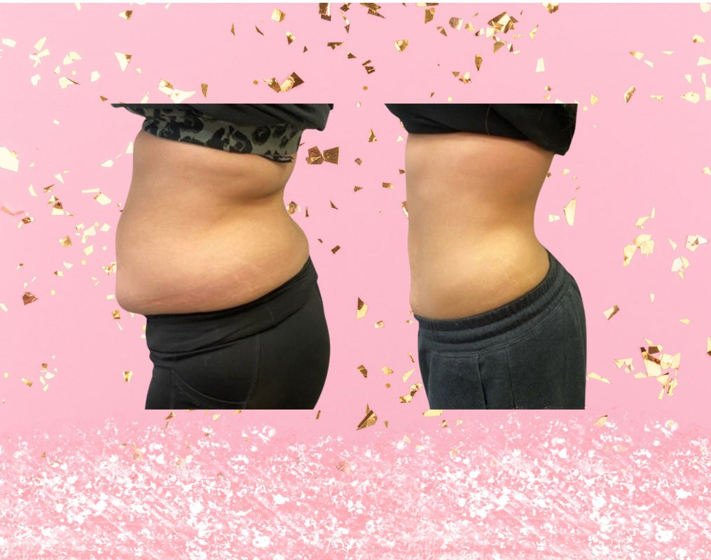 Body Sculpting Laser Lipo Cavitation