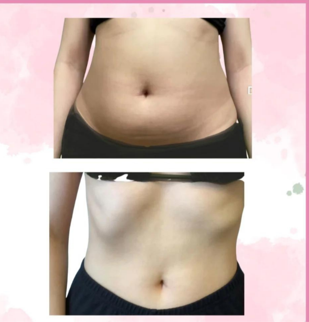Lipo Fat Melting Cream