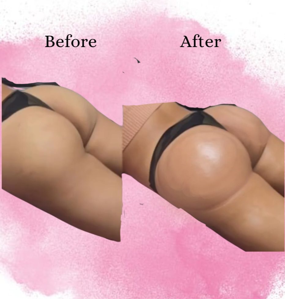 Buttocks Enhancement Pills