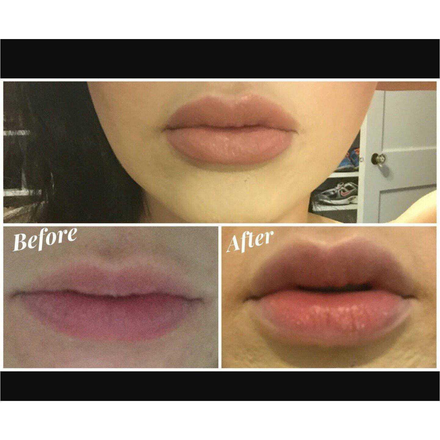 All Lip Plumper Gloss All Lip Plumper Gloss 7 Enhancements