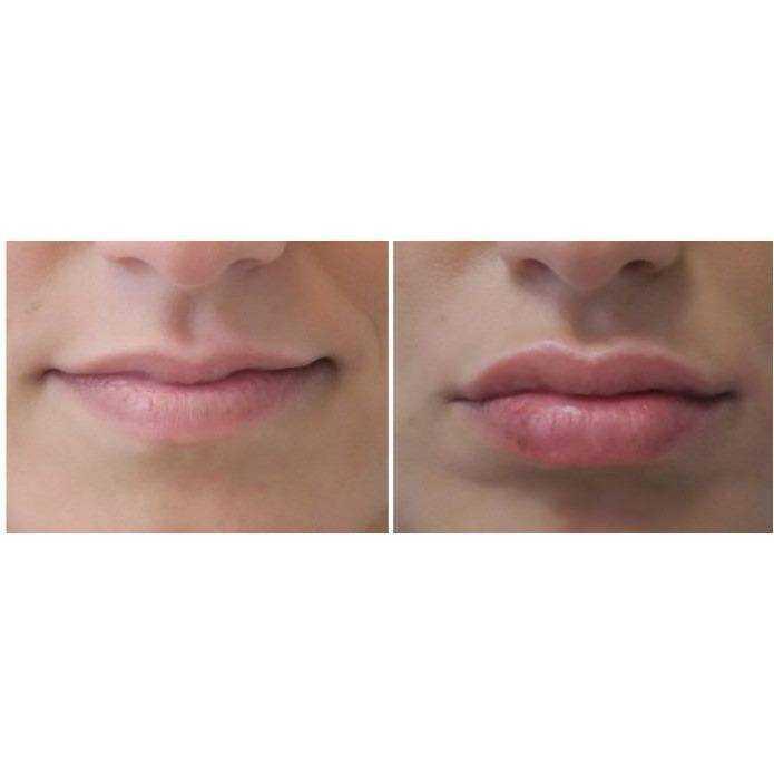 All Lip Plumper Gloss All Lip Plumper Gloss 7 Enhancements