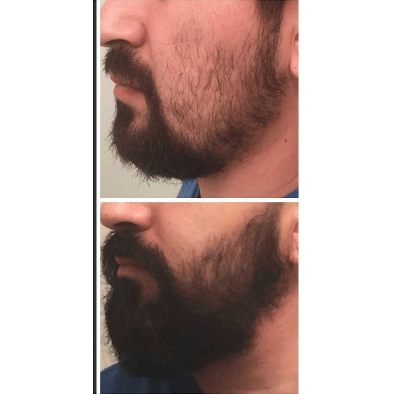 Beard Extreme Growth Oil 1.3oz Beard Extreme Growth Oil 1.3oz 12 Men's Skin Care