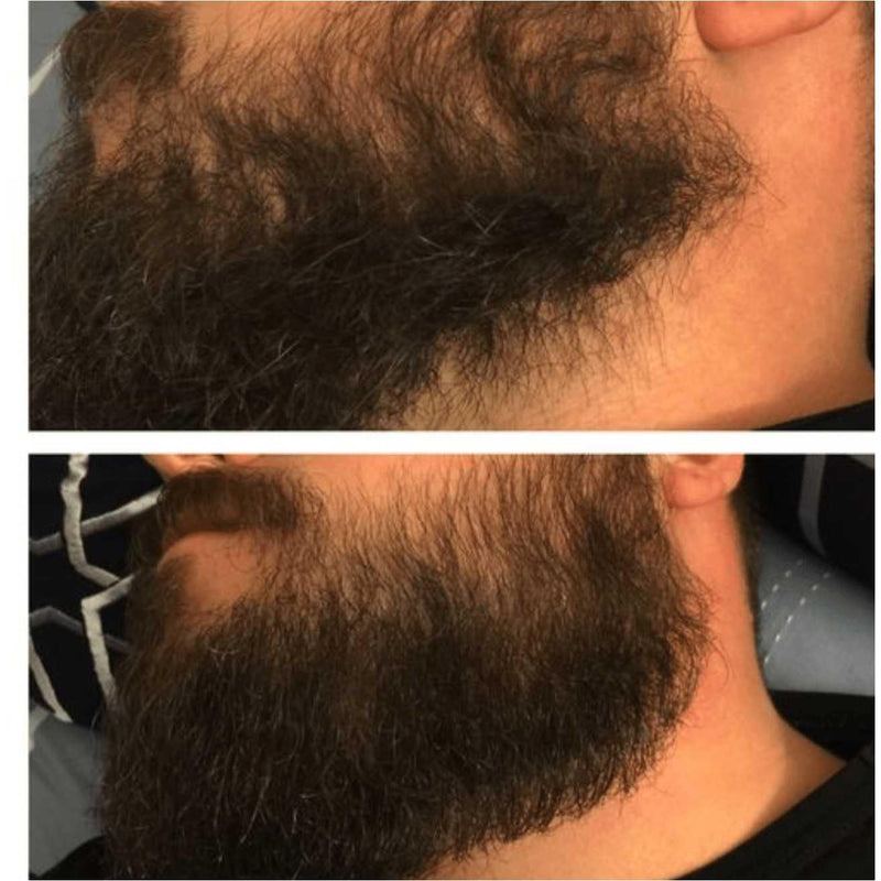 Beard Extreme Growth Oil 1.3oz Beard Extreme Growth Oil 1.3oz 12 Men's Skin Care