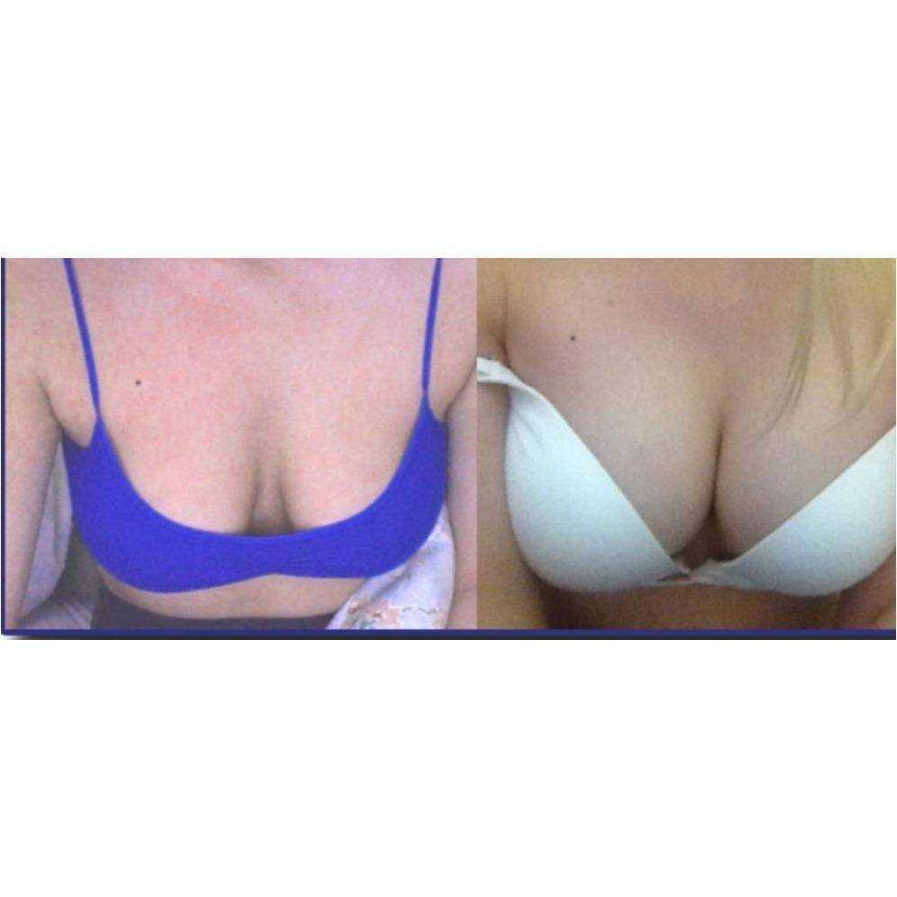 Bigger Breast Enhancement Pills Bigger Breast Enhancement Pills 21 Enhancements