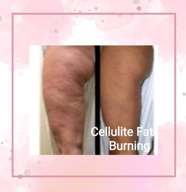 Cellulite & Fat Reducing Oil Cellulite & Fat Reducing Oil 28 Body Products