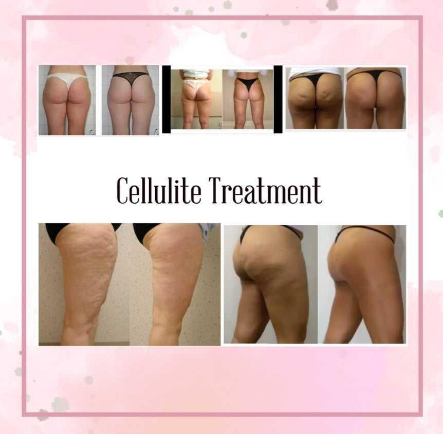 Cellulite & Fat Reducing Oil Cellulite & Fat Reducing Oil 28 Body Products