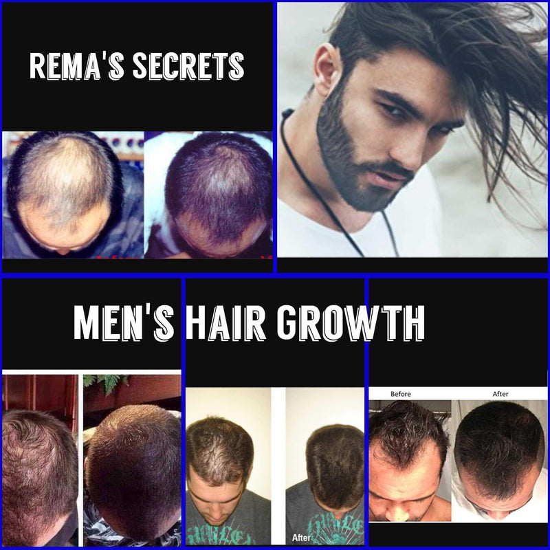 Men's Rapid Hair Growth Serum Men's Rapid Hair Growth Serum 15 Men's Skin Care
