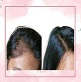 All Rapid Hair Growth Treatments All Rapid Hair Growth Treatments Oil 22 Enhancements