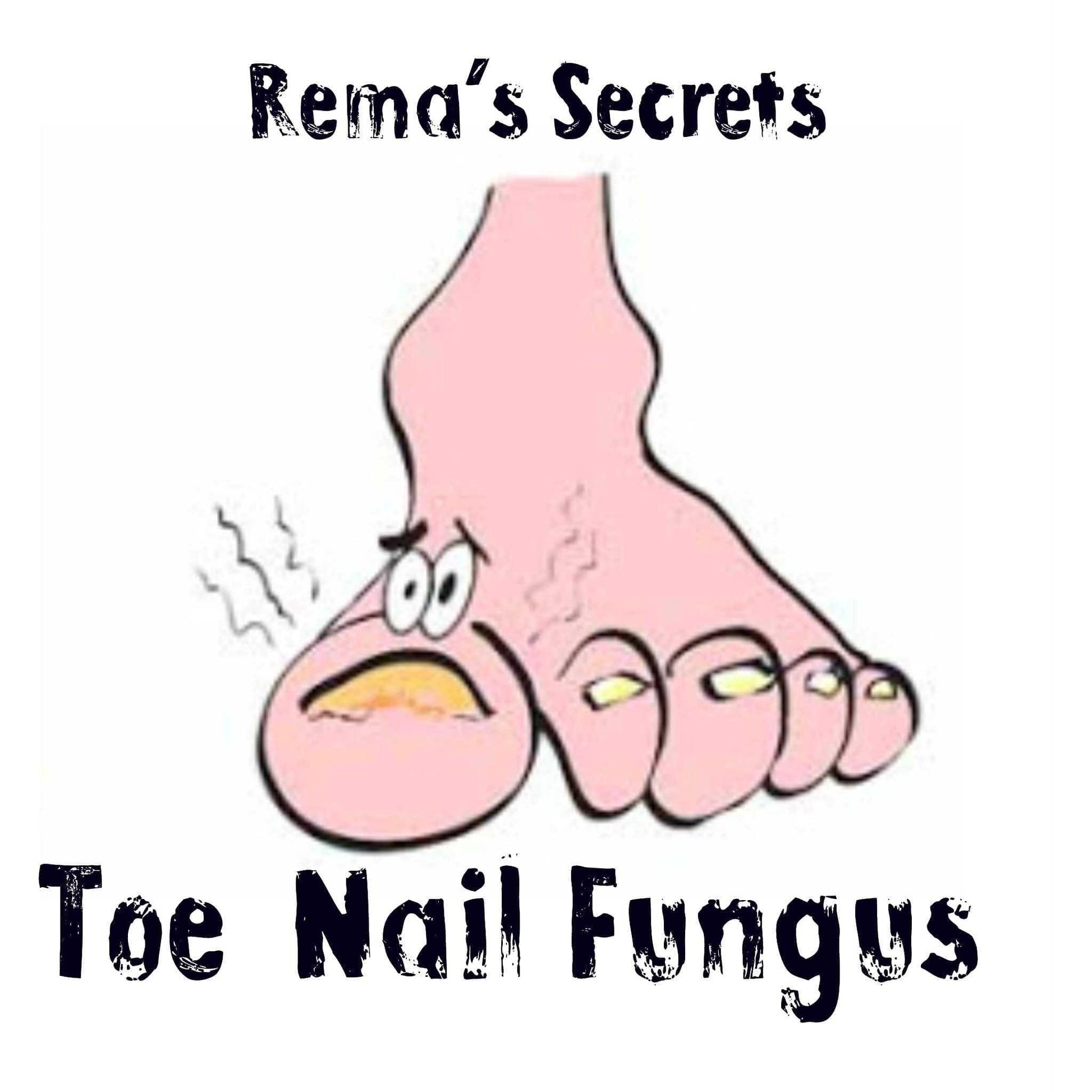 Toe Nail Fungus Oil 2oz Treatment Toe Nail Fungus Oil 2oz Treatment 8 Body Products