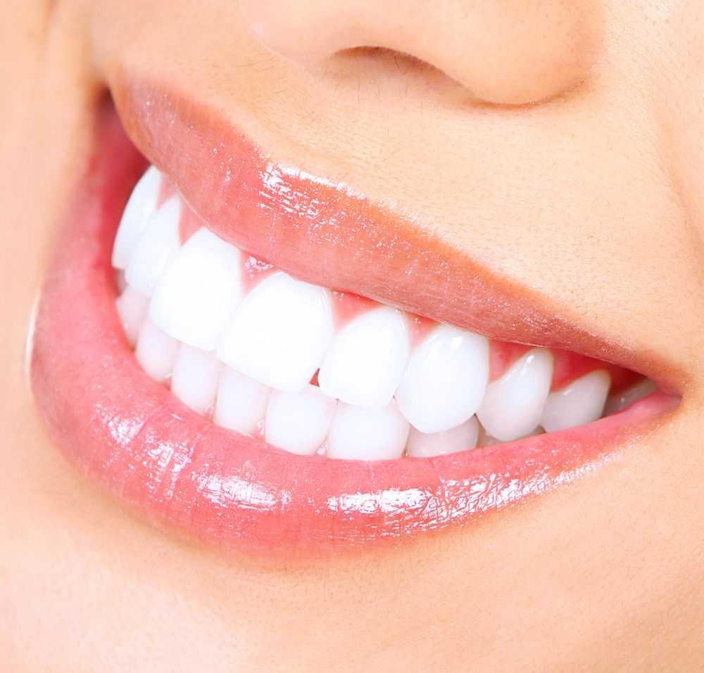 Whitening OR/ Cavity Repair Treatment Whitening OR/ Cavity Repair Treatment charcoal bleach 7 Enhancements