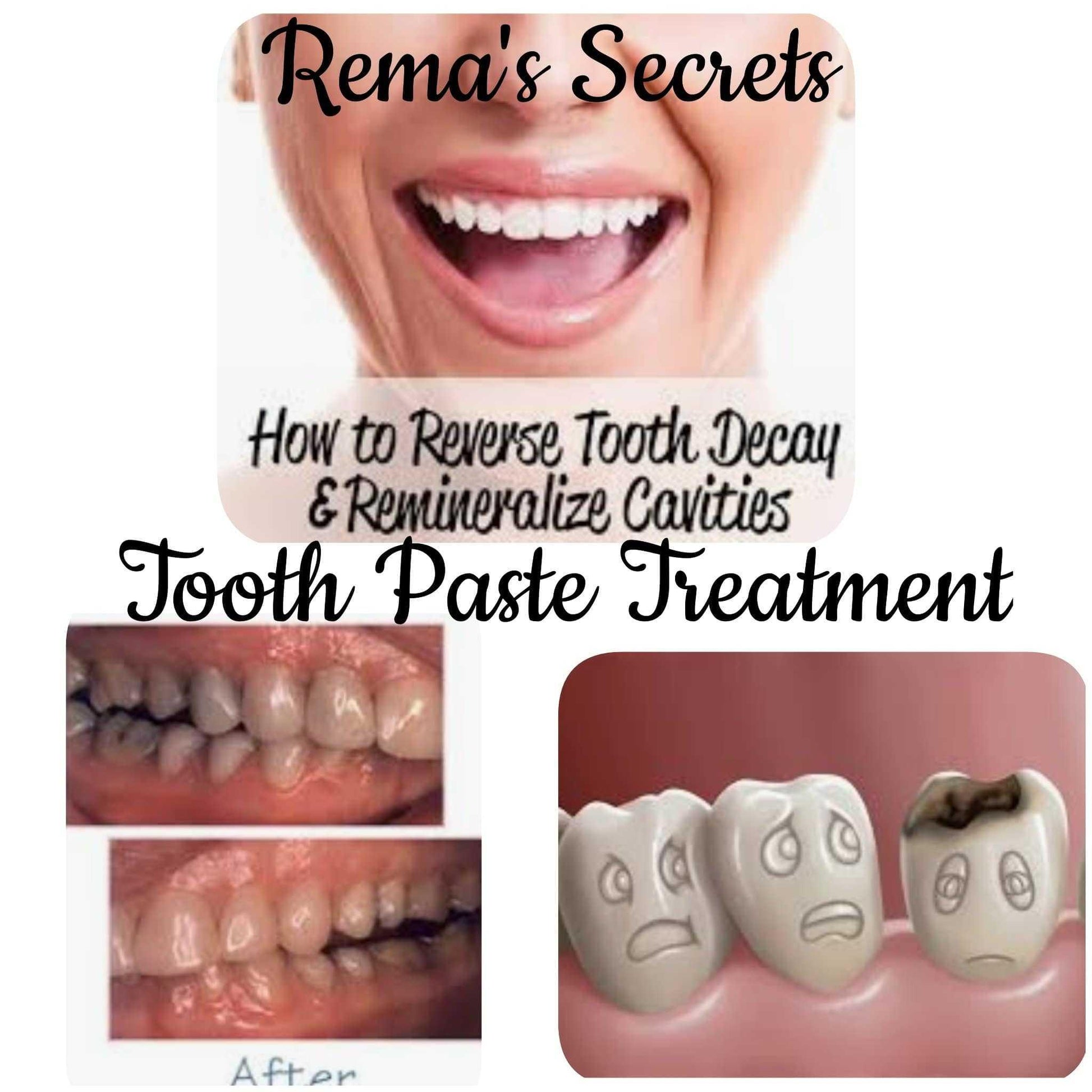 Whitening OR/ Cavity Repair Treatment Whitening OR/ Cavity Repair Treatment charcoal bleach 7 Enhancements